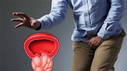 a prostatitis szexuális életet okoz